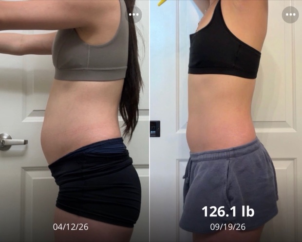 Client progress, before beside after